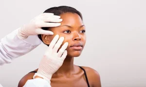 Dermatologist Treatments